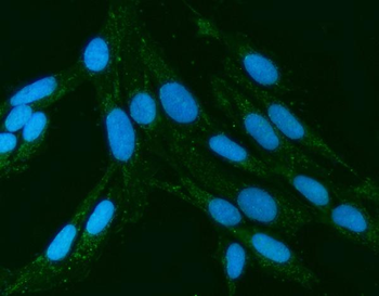 Kindlin 2/FERMT2 Rabbit Polyclonal Antibody