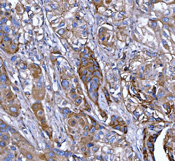 Kindlin 2/FERMT2 Rabbit Polyclonal Antibody