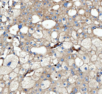 Kindlin 2/FERMT2 Rabbit Polyclonal Antibody