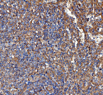 Kindlin 2/FERMT2 Rabbit Polyclonal Antibody