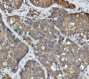 FADS1 Rabbit Polyclonal Antibody