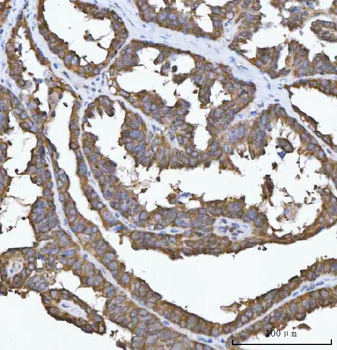FADS1 Rabbit Polyclonal Antibody