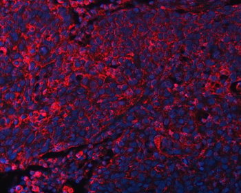 DOCK180/DOCK1 Antibody