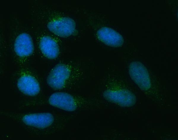 ZNRF3 Rabbit Polyclonal Antibody