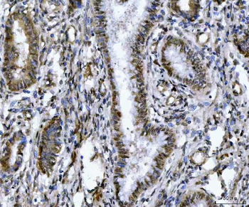 ZMYND8 Rabbit Polyclonal Antibody