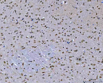 ZMYND8 Rabbit Polyclonal Antibody
