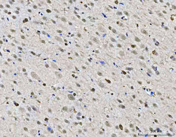 ZMYND8 Rabbit Polyclonal Antibody