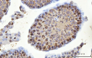 MSY2/YBOX2/YBX2 Rabbit Polyclonal Antibody
