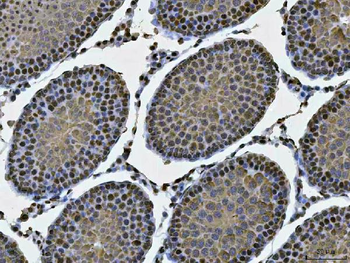 MSY2/YBOX2/YBX2 Rabbit Polyclonal Antibody