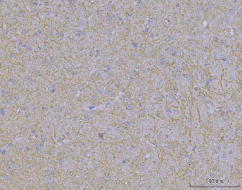 WDR7 Rabbit Polyclonal Antibody