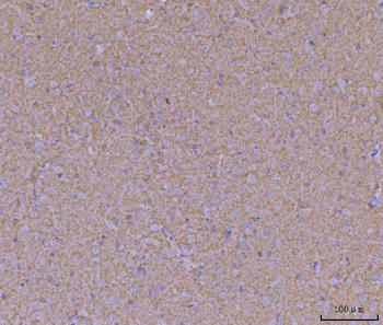 WDR7 Rabbit Polyclonal Antibody