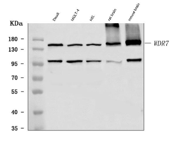 WDR7 Rabbit Polyclonal Antibody