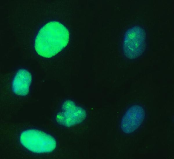 UBE2S Antibody