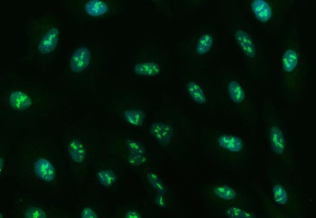 Ubc13/UBE2N Antibody
