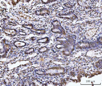 UBA6 Rabbit Polyclonal Antibody