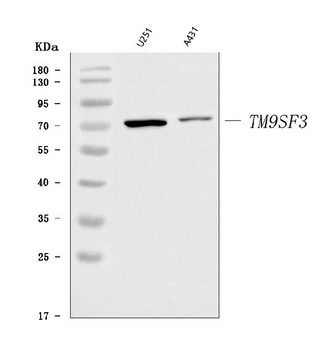 TM9SF3 Rabbit Polyclonal Antibody