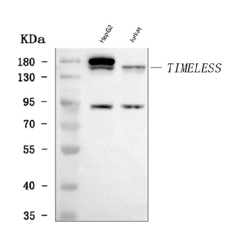 TIMELESS Rabbit Polyclonal Antibody