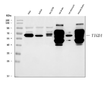 TIGD1 Antibody