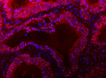 TIGD1 Antibody