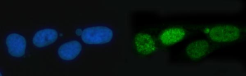 TIGD1 Antibody