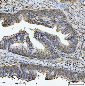 TIGD1 Antibody