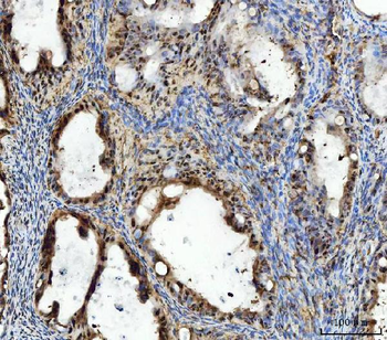 TIGD1 Antibody