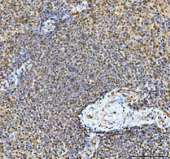 TIGD1 Antibody
