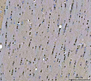 TIGD1 Antibody