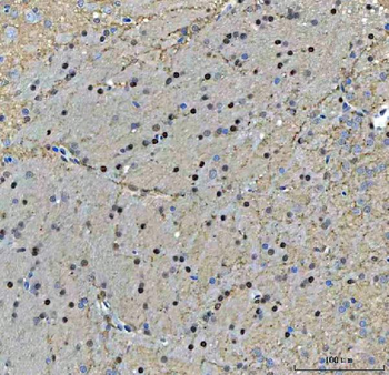 TIGD1 Antibody