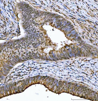 THAP11 Antibody