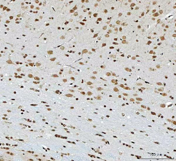 THAP11 Antibody