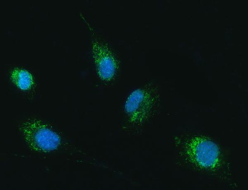 TRK fused gene/TFG Rabbit Polyclonal Antibody