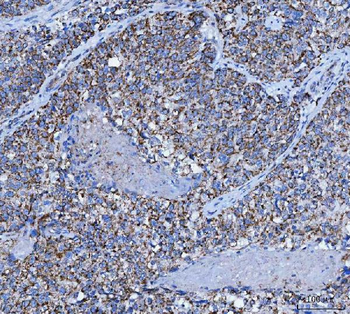 TRK fused gene/TFG Rabbit Polyclonal Antibody