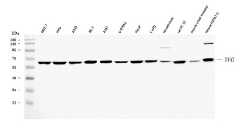 TRK fused gene/TFG Rabbit Polyclonal Antibody