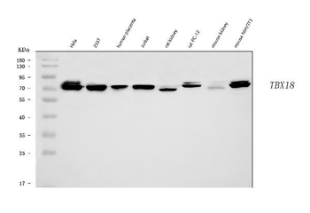 TBX18 Antibody