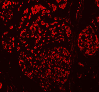 TBX18 Antibody
