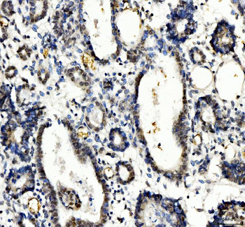 TBX18 Antibody