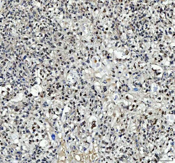 TBX18 Antibody