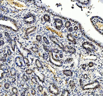 TBX18 Antibody
