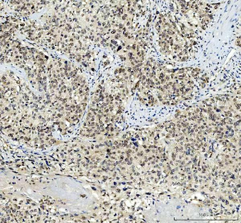 TBX18 Antibody