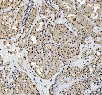 TBX18 Antibody