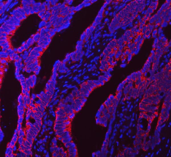 NDUFS5 Antibody