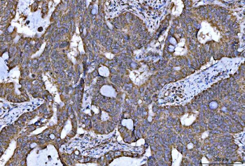 NDUFS5 Antibody