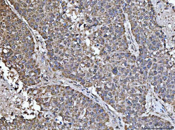 NDUFS5 Antibody