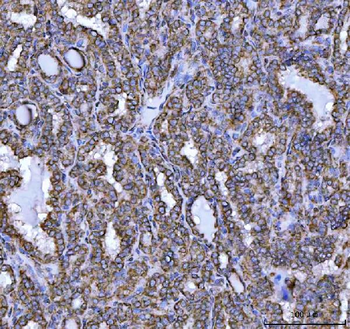 NDUFS5 Antibody