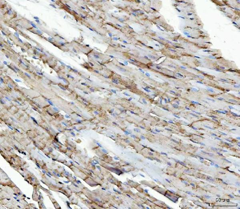 NDUFS5 Antibody