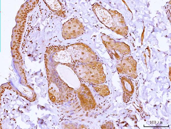 HOXC12 Rabbit Polyclonal Antibody