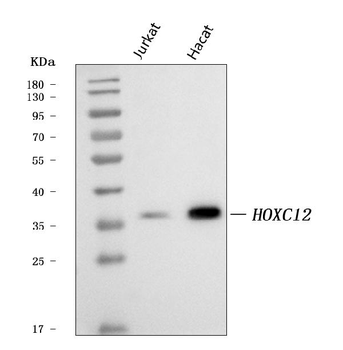 HOXC12 Rabbit Polyclonal Antibody