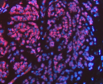FIP1L1 Antibody