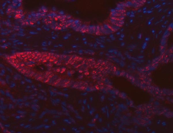 FIP1L1 Antibody